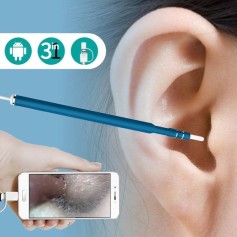 Endoskopkamera HD 720P für Android - Sichere Ohrüberwachung zuhause